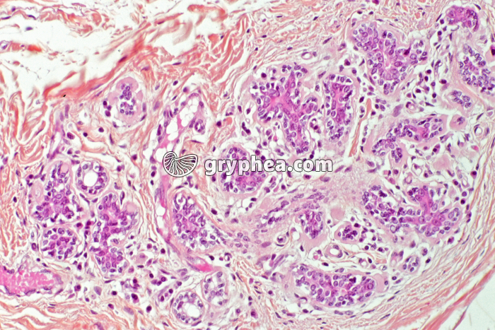 Glande mammaire humaine x70 - gryphea.org